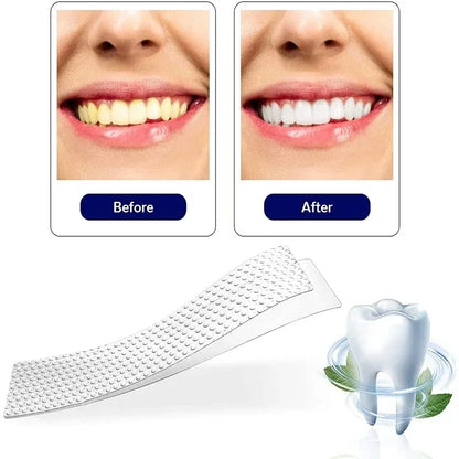 Whitening strips